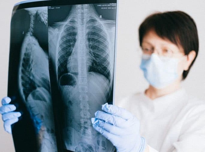 sesak_nafas_adalah_gejala_khas_pneumonia_yang_perlu_diwaspadai