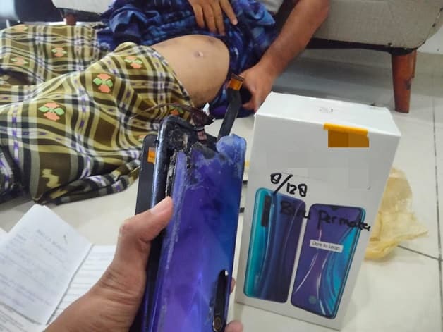 smartphone_warga_di_kisaran_mendadak_terbakar_di_saku_celana