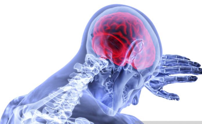 stroke_penyebab_kematian_tertinggi_kedua_di_dunia