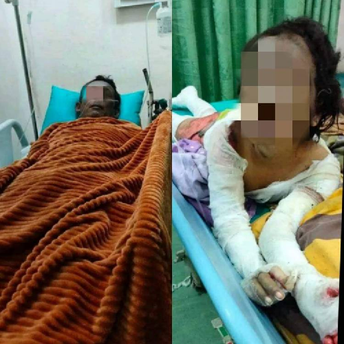 susul_kedua_orangtuanya_bocah_7_tahun_korban_kebakaran_di_tebing_tinggi_meninggal