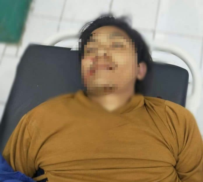 tabrak_truk_dua_mahasiswa_asal_medan_tewas_di_dairi