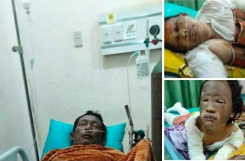tabung_gas_meledak_1_unit_rumah_di_tebing_tinggi_terbakar_3_luka