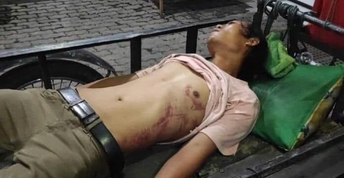 terkait_kasus_warga_dipukuli_belasan_oknum_polisi_polda_sumut_meminta_maaf