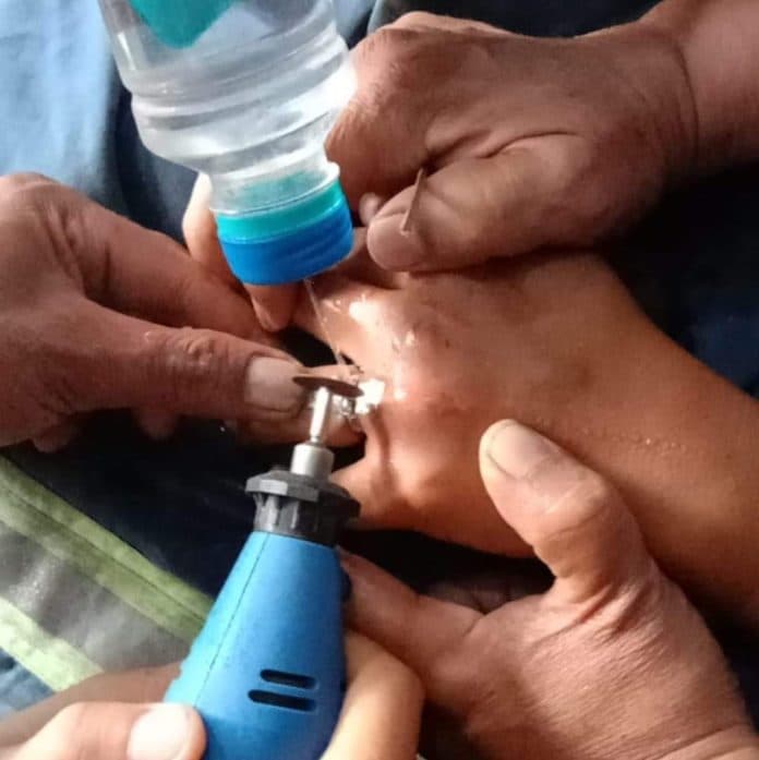 tiga_bulan_cincin_tak_bisa_lepas_warga_datangi_damkar_siantar