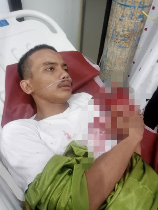 tiga_pelajar_sma_dibacok_geng_motor_di_tanjung_morawa_tangan_nyaris_putus