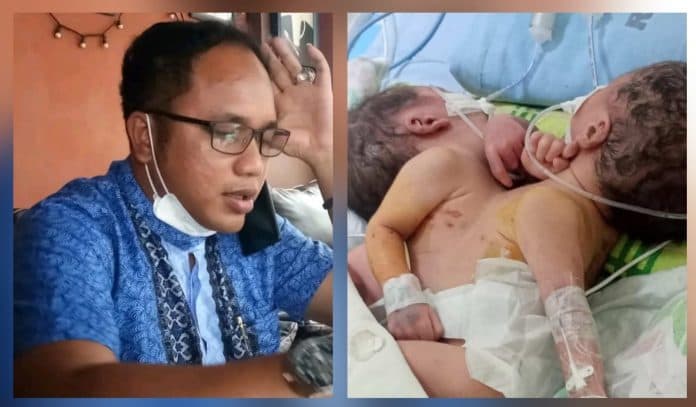 tim_kesehatan_pemkab_batu_bara_bertolak_ke_rsup_h_adam_malik_pantau_kondisi_bayi_kembar_siam
