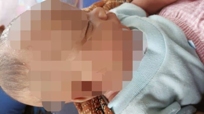 usai_minum_obat_di_posyandu_kulit_bayi_di_deli_serdang_berubah_warna
