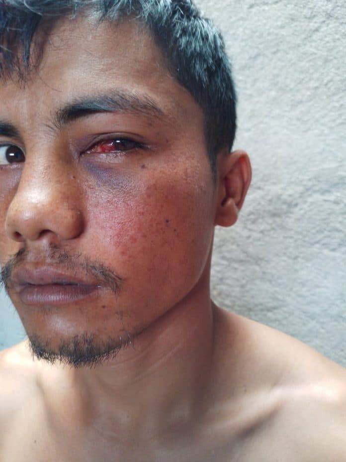 usai_terima_uang_damai_rp_50_juta_korban_malah_merasa_kurang