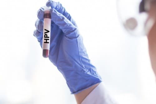 vaksin_hpv_diproduksi_secara_lokal_buat_penanggulangan_kanker_serviks_di_indonesia