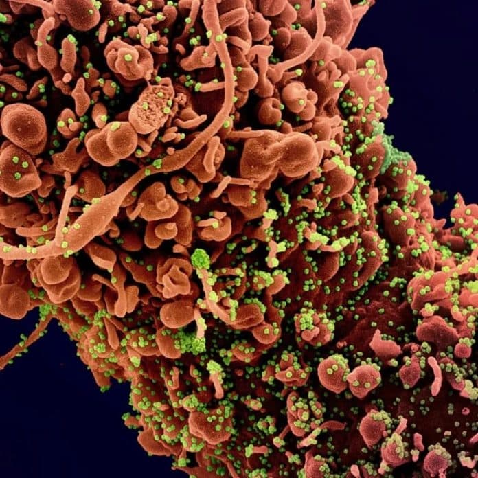 virus_corona_dapat_merusak_testis_tanpa_memasuki_sel