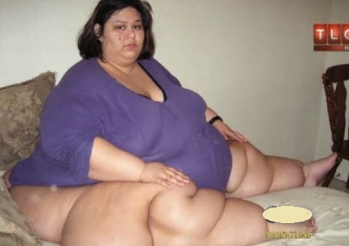 wanita_tergemuk_di_dunia_bobot_480_kg_kini_langsing_usai_diet