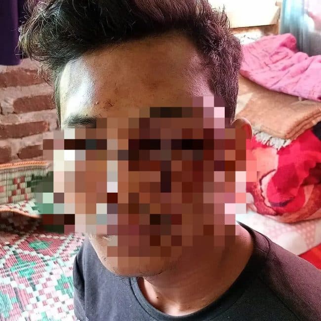 warga_patumbak_diculik_lalu_dianiaya_pria_diduga_oknum_tni