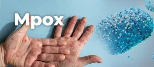 who_pertimbangkan_wabah_mpox_sebagai_keadaan_darurat_internasional
